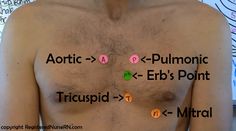 an image of a man with multiple signs on his chest and the words aortic = > > > + - pulmonic k - erb's point