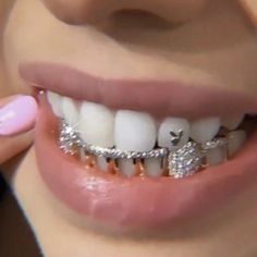 a close up of a person with braces on their teeth and diamond grills