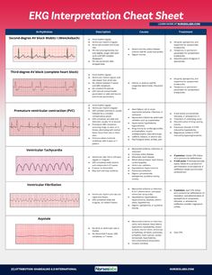 Ekg Cheat Sheet, Arrhythmias Nursing Cheat Sheets, Easy Ekg Interpretation Cheat Sheets, Heart Rhythm Nursing Cheat Sheets, Ekg Rhythms Cheat Sheets, Ekg Interpretation Made Easy Cheat Sheets, Telemetry Nursing Cheat Sheets, Acls Cheat Sheet 2023, Acls Cheat Sheet 2019