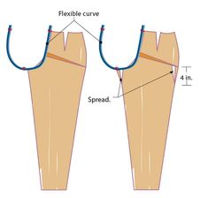 the diagram shows how to fix an ankle and foot spraining with a rubber band