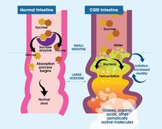 Read More about CSID - A Carbohydrate Digestive Disorder Starch Foods, Failure To Thrive, Gut Issues, Gi Tract, Starchy Foods, Carbohydrate Diet, Large Intestine, Abdominal Pain, Baby Formula