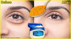 Puffy Bags, Bags Under Eyes, Remove Eye Bags, Mascara Hacks