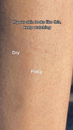 Unwanted Hair Permanently, Underarm Hair Removal, Cold Sores Remedies, Unwanted Facial Hair, Natural Sleep Remedies, Natural Cold Remedies, Cold Home Remedies, Natural Cough Remedies, Body Hair Removal