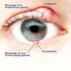 Optometry Education, Eyesight Problems, Eye Facts, Eye Anatomy, Gourmet Salt, Sweat Gland