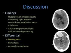 two mris are shown in black and white with the words,'discussion findings '