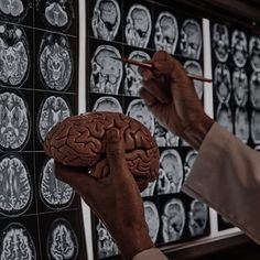 a person is pointing to a brain model