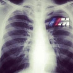 an x - ray image shows the chest and lungs