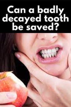 #Can a badly decayed tooth be saved ? Whiten Teeth Fast, Reverse Cavities, Strengthen Teeth