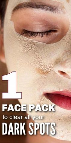 Brown Spots Removal, Brown Spots On Face, Dark Spots On Skin, Face Pack, Skin Spots, Spots On Face, Remove Dark Spots