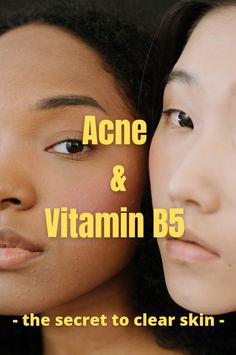 Vitamin For Acne Clear Skin, Best Vitamins For Acne, Vitamins For Hormonal Acne, Vitamins For Acne Clear Skin, Face Acne Remedies, Supplements For Acne, Best Acne Scar Removal, Chin Acne, Cystic Acne Remedies