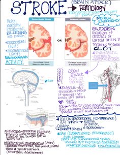 a diagram of the brain and its functions