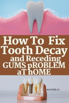 #toothdecay #toothproblem #WhatAreOralCare #WhatIsOralCare #HowToCareForOralHealth #WhyOralCareIsImportantForElderly Gum Surgery, Gum Inflammation, Gum Recession, Vitamin C Supplement, Dental Instruments, Oil Pulling, Sugary Food