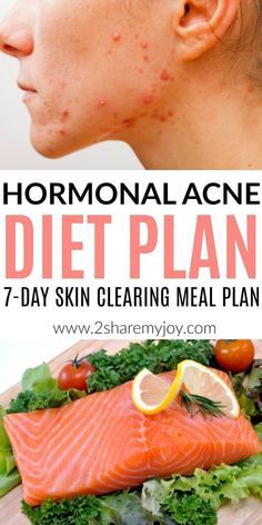 Sugar Free Meal Plan, Acne Triggers, Acne Diet Plan, Cucumber Diet, Low Carb Diets