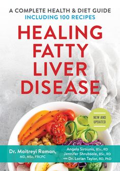 Written by experts and updated with the most current information available, this indispensable guide is for anyone living with fatty liver disease Some people with excess fat in the liver simply have what's called a fatty liver Although this is not normal, it's not serious if it doesn't lead to inflammation or damage However, once there's a build up of simple fat, the liver becomes vulnerable to injury, which may result in inflammation and scarring of the liver Others have what's called Nonalcoholic Steatohepatisis (NASH) Although it is similar to alcoholic liver disease, people with this type of fatty liver disease drink little or no alcohol NASH can lead to permanent liver damage, as the liver may enlarge and, over time, liver cells may be replaced by scar tissue This is called cirrhosis Unhealthy Diet, Well Balanced Diet, Diet Guide, Diet Vegetarian, Help Losing Weight