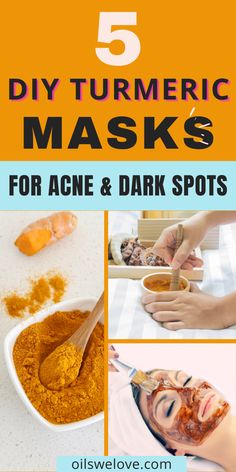 Diy Turmeric Face Mask, Turmeric Paste, Turmeric Mask, Pimples On Face, Acne Dark Spots, Tumeric Face Mask, Cold Medicine