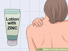 Oh, great! Another pimple—said no one ever. Acne isn't just limited to your face and can actually pop up on other parts of your body, including your back. If you're dealing with acne on your back, a.k.a. bacne, you may feel uncomfortable... Oh Great, Braces Off, Medical Terms, Simple Skincare, Beauty Treatments, Your Back, Skin Health, Clear Skin