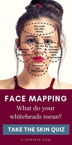 Face mapping - What do your whiteheads means? Take our skin quiz to discover the best skin care ritual based on your skin type, age, ethnicity, diet, and lifestyle. Gesicht Mapping, Face Map, Aesthetic Studio, Face Mapping, Skin Diet, Skin Quiz, Brown Spots On Face, The Best Skin Care, Makeup Tricks