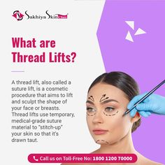 A thread lift is a nonsurgical facial rejuvenation procedure that passes threads beneath the surface of your skin, to lift the tissue. The threads may have tiny barbs or cones that help grip the skin. When appropriately positioned, they give your face a more lifted, toned appearance, especially around the lower face and jowls. Nose Thread Lift, Thread Lift Face Before And After, Face Lift With Threads, Thread Veins, Thread Lift Face, Lower Face Lift, Suture Material, Thread Lift, Facial Aesthetics