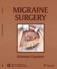 Dr. Guyuron Migraine Surgery Throbbing Headache, Headache Types, Peripheral Nerve, Migraine Relief, Migraine Headaches