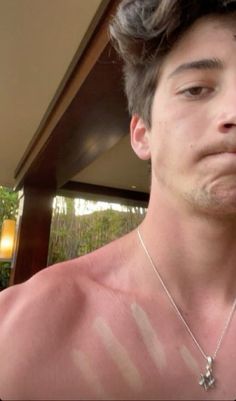 a shirtless man with sunburn on his chest