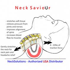 Neck Traction Can Be An Effective Therapy For Cervical Spine Problems & Can Help With Relief Of Pain, Nerve Pressure & Muscle Spasms Forward Head Posture Exercises, Spine Problems, Body Science, Neck Stretcher, Neck Traction, Cervical Traction, Neck Exercises, Yoga Wheel, Spine Health