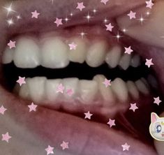 someone has their teeth painted pink with stars on them and there is a cat sticker in the bottom right corner