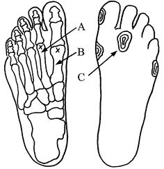 Tight It Band, Weak Ankles, Calf Pain, Megan Young, Longevity Diet, Trigger Point Massage, Referred Pain, Trigger Point Therapy, It Band