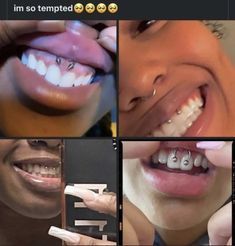 four different pictures of smiling people with braces and teeth, one showing the word smile