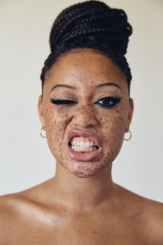 a woman with freckles on her face is making a funny face as she looks at the camera