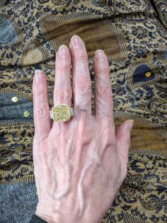 an older woman's hand with a yellow diamond ring on her left thumb and the middle finger