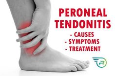 Let's take a look at the symptomscausesand treatment of peroneal tendonitisincluding treating peroneal tendonitis with compression socksYou can alleviate the pain of peroneal tendonitis as well as prevent it by wearing compression socks or foot compression sleeves. Ankle Rehab Exercises, Lower Limb Muscles, Lower Leg Pain, Nerve Pain Remedies, Pain Relief Remedies, Leg Cramps