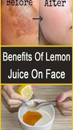 Lemon Juice On Face, Benefits Of Lemon Juice, Lemon Juice For Skin, Lemon Juice Face, Lemon Face, Juice For Skin, Lemon Juice Benefits, Benefits Of Lemon