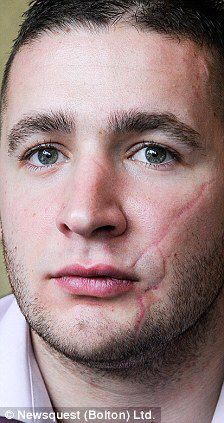 a man with freckles on his face looking at the camera while wearing a white shirt and tie