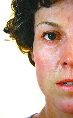 a woman with freckles on her face looking at the camera