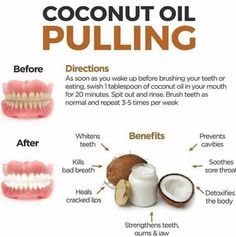 Oil Pulling Benefits, Benefits Of Coconut, Coconut Oil For Teeth, Whiter Teeth, Food Health Benefits, Coconut Oil Pulling, Teeth Health, Benefits Of Coconut Oil