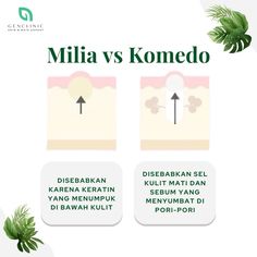 Kamu komedoan? Atau jangan-jangan milia? Ini dia perbedaannya!  Free konsultasi Wa: 0851-5056-8270 ☎️ : 021-55965828 📍jl. Marina raya, Rukan Exclusive blok B, No.56 Pantai Indah Kapuk, Jakarta Utara  #klinikkecantikan #klinikkecantikanjakarta #perawatanbadan #perawatanrambut #perawatanwajah #PIK Instagram Beauty, Beauty Recipe, Keratin, Singapore, Instagram Profile, Social Media