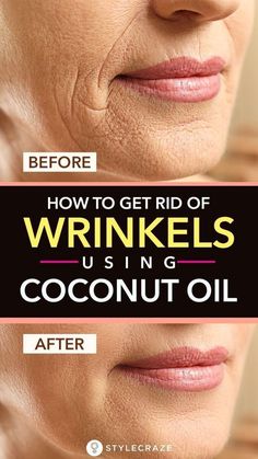 Get Rid Of Wrinkles, Skin Care Wrinkles, Baking Soda Shampoo, Beauty Tips For Face, Natural Beauty Tips, Best Anti Aging, Anti Aging Skin Products, Aging Skin Care, Facial Care