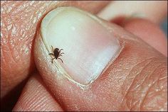 a tick sitting on the tip of someone's finger with it's nail