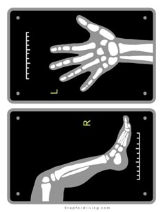 two signs with the same hand and foot on each side, one showing an x - ray