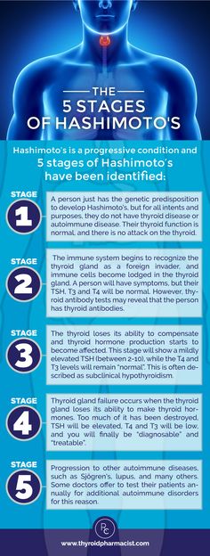 Discover eighteen ways that you can help ward off developing an autoimmune thyroid condition. How many are you doing? Swollen Thyroid, Health Info, Holistic Health, How Many