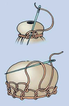 two balls of yarn with knitting needles in the middle one is white and the other is brown