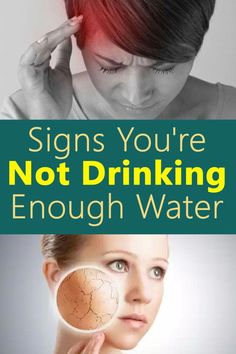 Proper Hydration, Drinking Enough Water, Water Health, Not Drinking Enough Water, Daily Water Intake, Holistic Health Remedies, Natural Healing Remedies, Health Trends, Daily Health Tips