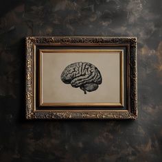 a framed photograph of a human brain on a black and gold wallpapered room