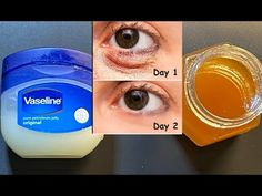 Vaseline Under Eyes, Eye Wrinkles Remedies, Vaseline For Face, Face Wrinkles Remedies, Puffy Eyes Remedy, Wrinkles Remedies, Wrinkles Remedies Face, Eye Wrinkles, Eye Puffiness