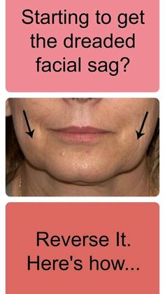 Face Lift Exercises, Face Lift Surgery, Anti Aging Food, Face Exercises, Glow Skin, Facial Exercises, Facial Muscles, Face Lift, Muscle Tone