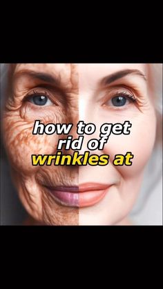 How To Remove Wrinkles On Face, How To Get Rid Of Wrinkles, Wrinkle Remedies Face, Remove Wrinkles From Face, Natural Wrinkle Reducer, Natural Wrinkle Remedies, Wrinkles Remedies, Home Remedies For Wrinkles