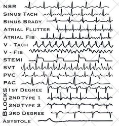 EKG Strip file for the cardiac lover in your life.  This is a DIGITAL SVG FILE ONLY, no physical item will be sent.  - Once you have completed your purchase, a link to download will be sent to the e-mail account registered to your Etsy account. - Design can be downloaded and cut with any silhouette, cricut, or other scan and cut. - Please do not resell or share the digital files. ⚠️ - Digital files CANNOT BE REFUNDED. If you have any problems, concerns and queries with your downloads, feel free Type A Aesthetic, Cardiac Sonography, Nursing School Inspiration, Medical Assistant Student, Nursing School Essential, Medical School Life, Nursing School Motivation