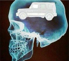 an x - ray image of a car in the shape of a human head