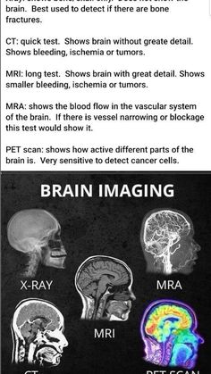 the brain and its functions are shown in black and white