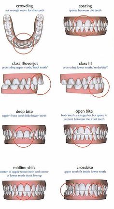 Dental Hygiene Student, Dental Videos, Dental Hygiene School, Dentistry Student, Dental Anatomy